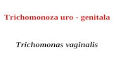 Curs 2-2 Trichomonas