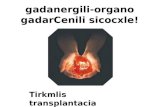 Gadanergili-organo gadarCenili sicocxle! Tirkmlis transplantacia.