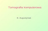 Tomografia komputerowa B. Augustyniak. Tomografia komputerowa – CT 3D.