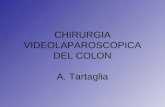 CHIRURGIA VIDEOLAPAROSCOPICA DEL COLON A. Tartaglia.