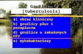 Gruźlica [tuberculosis]