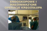 Endoskopowe I MAŁOINWAZYJNE operacje kręgosłupa