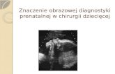 Znaczenie obrazowej diagnostyki prenatalnej w chirurgii dziecięcej