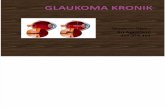 Sri - Glaukoma Kronik-End