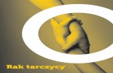 Rak Tarczycy - Io.gliwice.pl