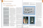 Ms Magazyn 12-2008.pdf · Implantologia stomatologiczna Zarys implantologiü CZQéé lla Klasyfikacja wszczepów i materiaty stosowane w implantacji zy. Ksztaltem przypominaly grzyb.