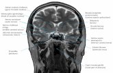 Zakręt czołowy środkowy - iMULpl.imul.pl/sites/default/files/Praktyczny_Radiol_2015.pdf · (vitreus body) t. środkowa mózgu (middle cerebral artery) Zbiorniki okołosiodłowe