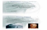 Metody obrazowania wmedycynie - sound.eti.pg.gda.pl · – Tomografia emisyjna pojedynczego fotonu (SPECT) – Optyczna tomografia koherencyjna (OCT) Ultrasonografia (USG) † Ultrasonografia
