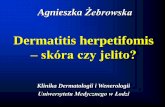 Prezentacja programu PowerPoint - termedia.pl · nowotwory przewodu pokarmowego Powikłania: Dermatitis herpetifomis dlaczego jelito i skóra? Title: Prezentacja programu PowerPoint
