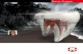 BioRoot RCS - septodont.com.pl RCS czy... · w obszarze płaszczyzna kontaktu materiał-ząb (21). Ta właściwość jest ważna dla uszczelniaczy, ponie-waż wiązanie uszczelniacza