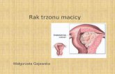 Rak trzonu macicy - uczkin.pluczkin.pl/storage/files/Seminaria 2017 5 rok/Rak trzonu macicy 5... · życiowe wystąpienia tego nowotworu wynosi 40-60%. Co jeszcze ... biologia raka