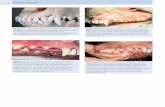 8 ANATOMIA I FIZJOLOGIA - Edra Urban & Partner · 8 ANATOMIA I FIZJOLOGIA Rycina 2.1 Pies średnioczaszkowy – nożycowy zgryz w obszarze zębów siecznych. Łuk zębów siecznych