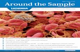 ISSN 2353-7191 Around the Sample - horiba.com · Szpiczak plazmocytowy IgE? Gamma-glutamylotranspeptydaza (GGTP) - czy tylko marker wdiagnostyce schorzeń wątroby? ... elementem