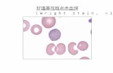 好塩基性斑点赤血球 (Wright stain, ×1,000） new...好塩基性斑点・赤芽球 (Wright stain, ×1,000) 骨髄像。過形成でM/E比0.7と赤芽 球系の過形成。赤芽球は好塩基性斑点が