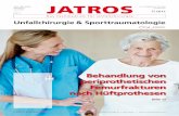 JATROS - unfallchirurgen.at · The New Nailing Portfolio from Zimmer Cephalomedullary Nail* • Anatomically shaped nails both for the short and long nails to better fit the medullary