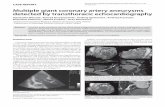 Multiple giant coronary artery aneurysms detected by ... giant coronary.pdf · Coronary artery aneurysms are quite rare abnormalities, defined as a dilated coronary artery exceeding