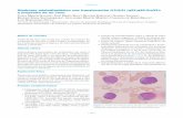 Síndrome mielodisplásico con translocación t(3;3;5) (q21 ...gechem.org/php/images/web/casos/2014_caso3.pdf · Síndrome mielodisplásico tipo AREB con t(3;3;5) (q21;q26.2;q32).