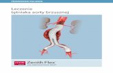 Leczenie tętniaka aorty brzusznejhammer.pl/wp-content/uploads/2015/11/Leczenie-tętniaka...Niestety, w większości przypadków tętniak aorty brzusznej nie powoduje żadnych objawów.