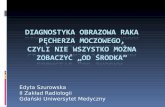 Edyta Szurowska II Zakład Radiologii Gdański Uniwersytet ...pliszka.net/uro-files/2014/prezentacje/4-szurowska.pdfTradycyjne podejście polegające na wykonywaniu USG, klasycznej
