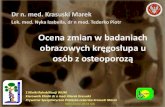 Ocena zmian w badaniachkrasuski.krasuski.nazwa.pl/kursy/files/Ocena-zmian-w-ba... · 2013. 10. 13. · Ocena zmian w badaniach obrazowych kręgosłupa u osób z osteoporozą Dr n.