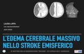 UOC NEUROCHIRURGIA AOUS SIENA L’EDEMA CEREBRALE · PDF file EDEMA CEREBRALE Overall risk per stroke del circolo anteriore: 10-20% Occorre ++ nei primi 4 giorni (72-96 h), late 4-10