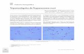 Tripomastigotes de Trypanosoma cruzi